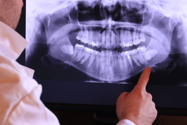 Best Dental Abscess Treatment in Lake Shastina, CA