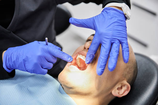 Best Emergency Cosmetic Dentistry (e.g., broken veneers) in Lake Shastina, CA